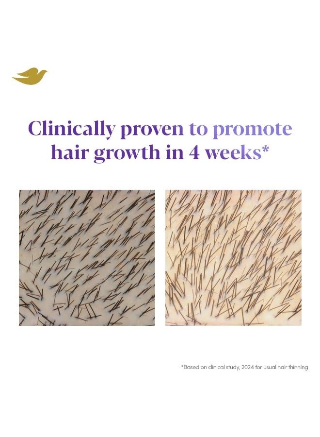 Dove Scalp + Hair Therapy Density Boost Revitalizing Scalp Serum with active ingredients 2.5% Niacinamide and 1.5% Zinc-peptides for visibly denser hair growth 50ml - Image 2